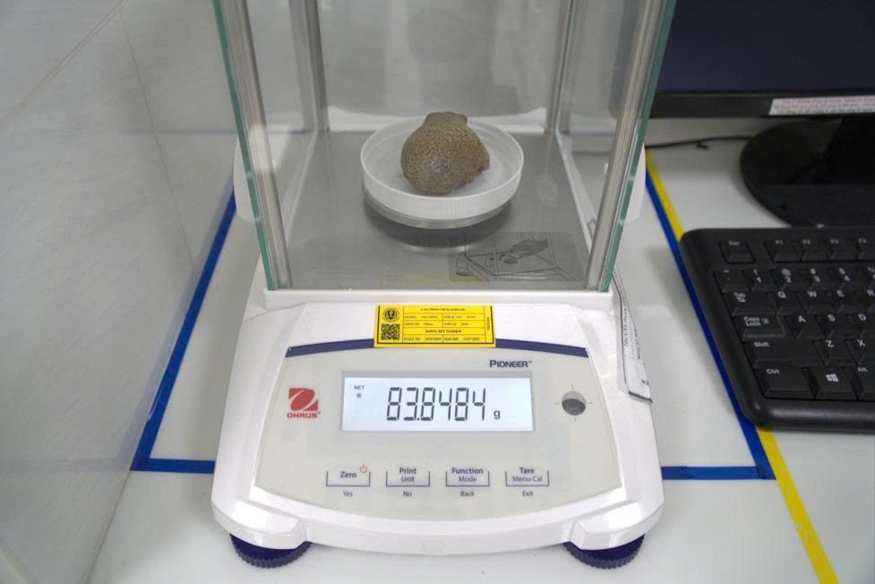Khối lượng nặng 83,848 gram. Ảnh: Bệnh viện cung cấp