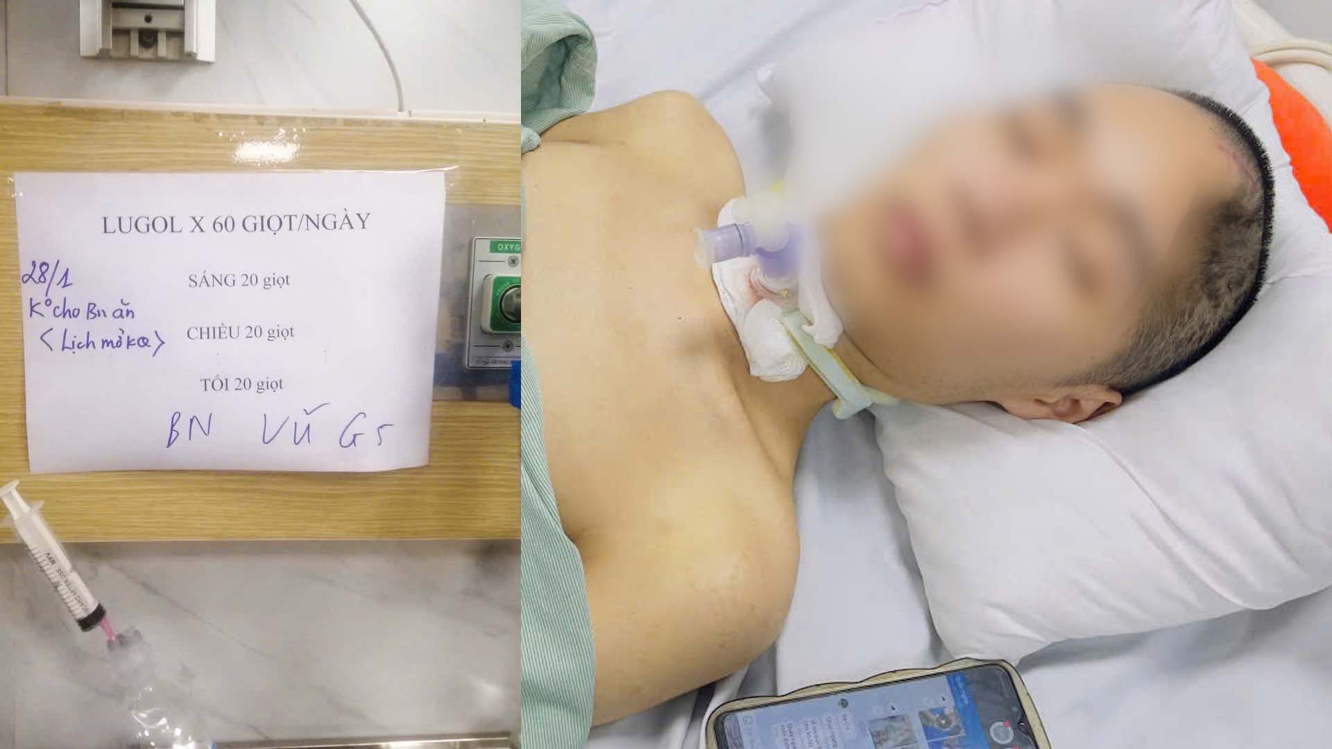 Vu - a 4th-year male student who had an accident is being treated at the Central Hospital of Traditional Medicine (Hanoi). Photo: NVCC