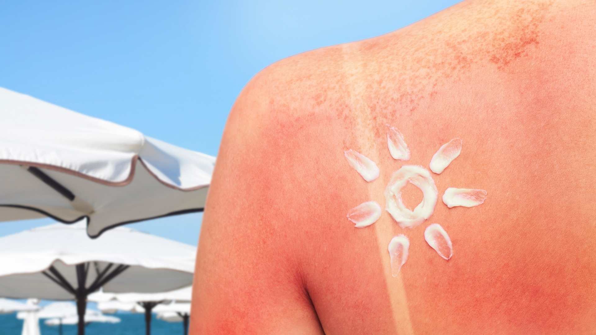 Sunscreen clothing is rated higher than regular creams