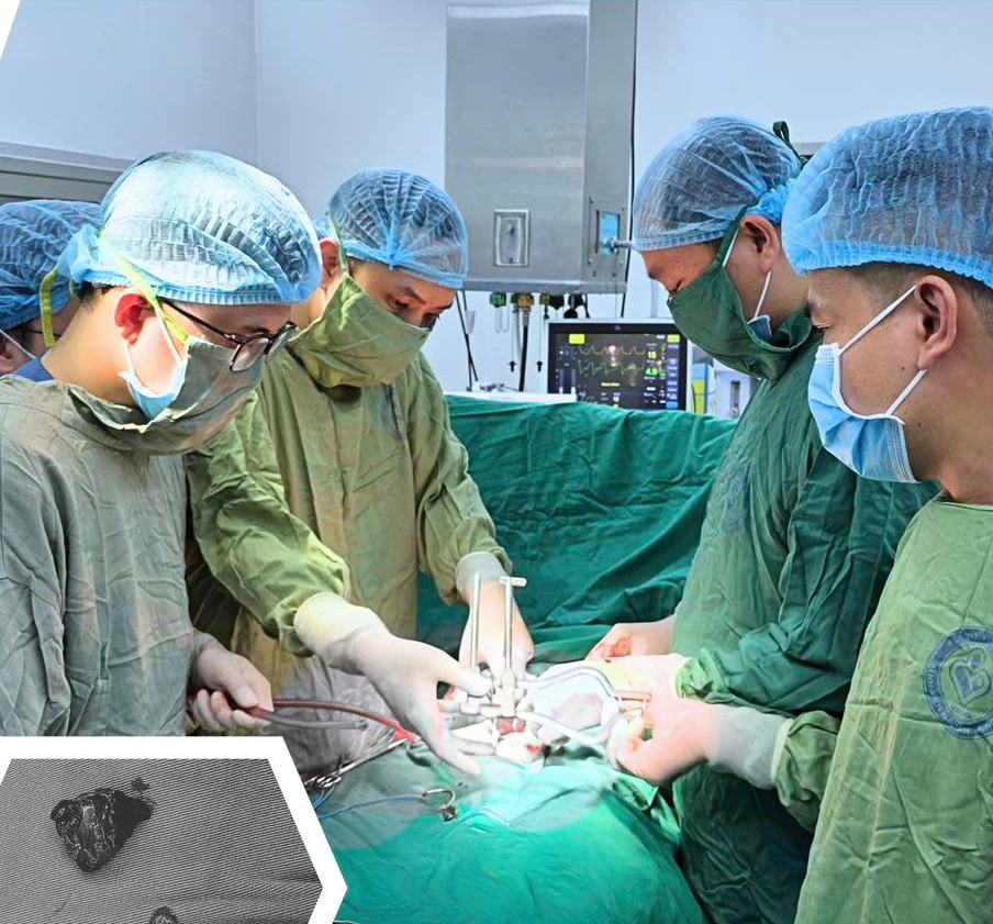 Doctors at the Central Obstetrics and Gynecology Hospital successfully handle an ectopic pregnancy in a particularly rare location. Photo: BVCC