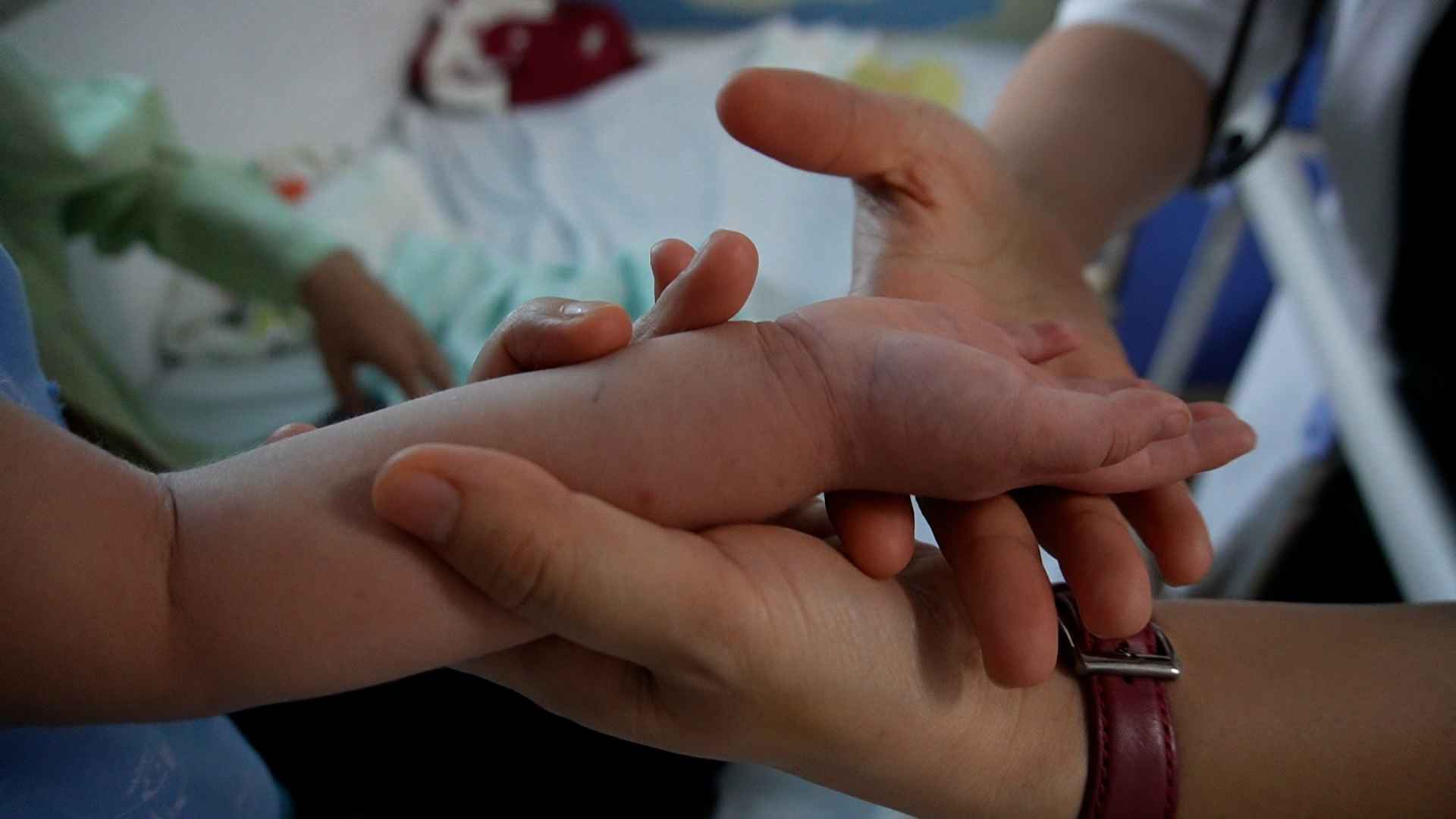 Lần đầu mắc bệnh, con chị Mai được chẩn đoán nhiễm chủng Coxsackievirus A16 (CA16) với biểu hiện điển hình như sốt và nổi ban ở tay chân. Tuy nhiên, ở lần thứ hai khi nhiễm Enterovirus 71 (EV71), bé lại không sốt, không nổi ban, khiến gia đình khó phát hiện hơn. Đến lần này, bé tiếp tục tái nhiễm chủng CA16. Ảnh: Hạnh Thơm