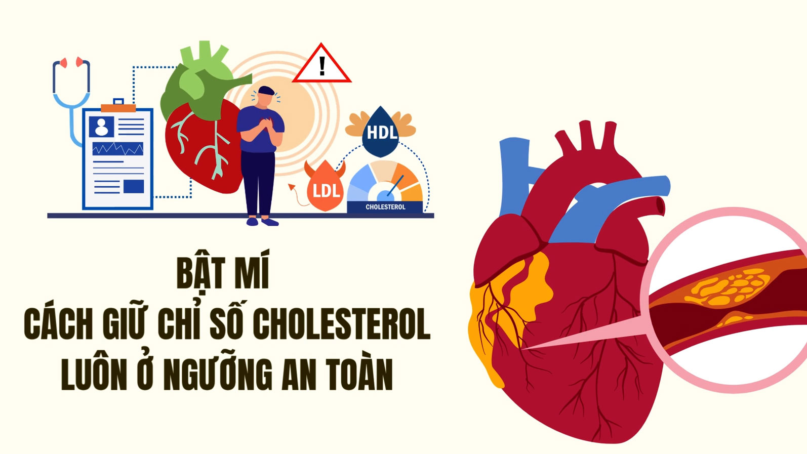 Maintain a stable cholesterol level through a healthy lifestyle and regular check-ups.