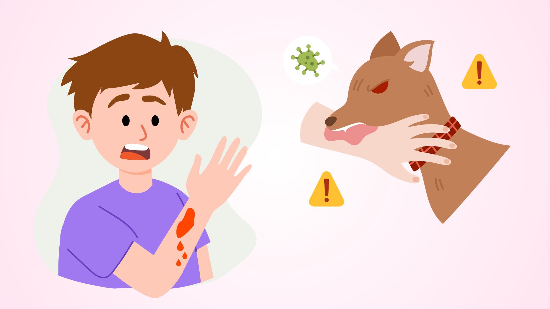 2 steps to take when contacting animal saliva suspected of being infected with rabies.