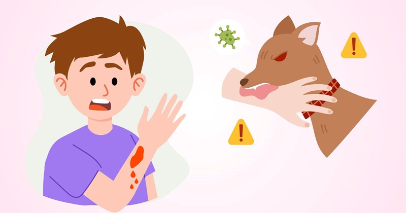 2 bước xử lý khi tiếp xúc với nước bọt động vật nghi dại