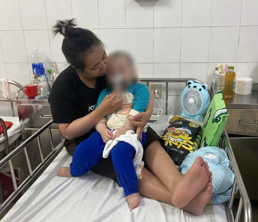 In addition to brain deformities, baby D is frequently hospitalized due to epilepsy attacks, having to breathe in oxygen tanks due to pneumonia and respiratory failure. Photo: Ngo Hien.