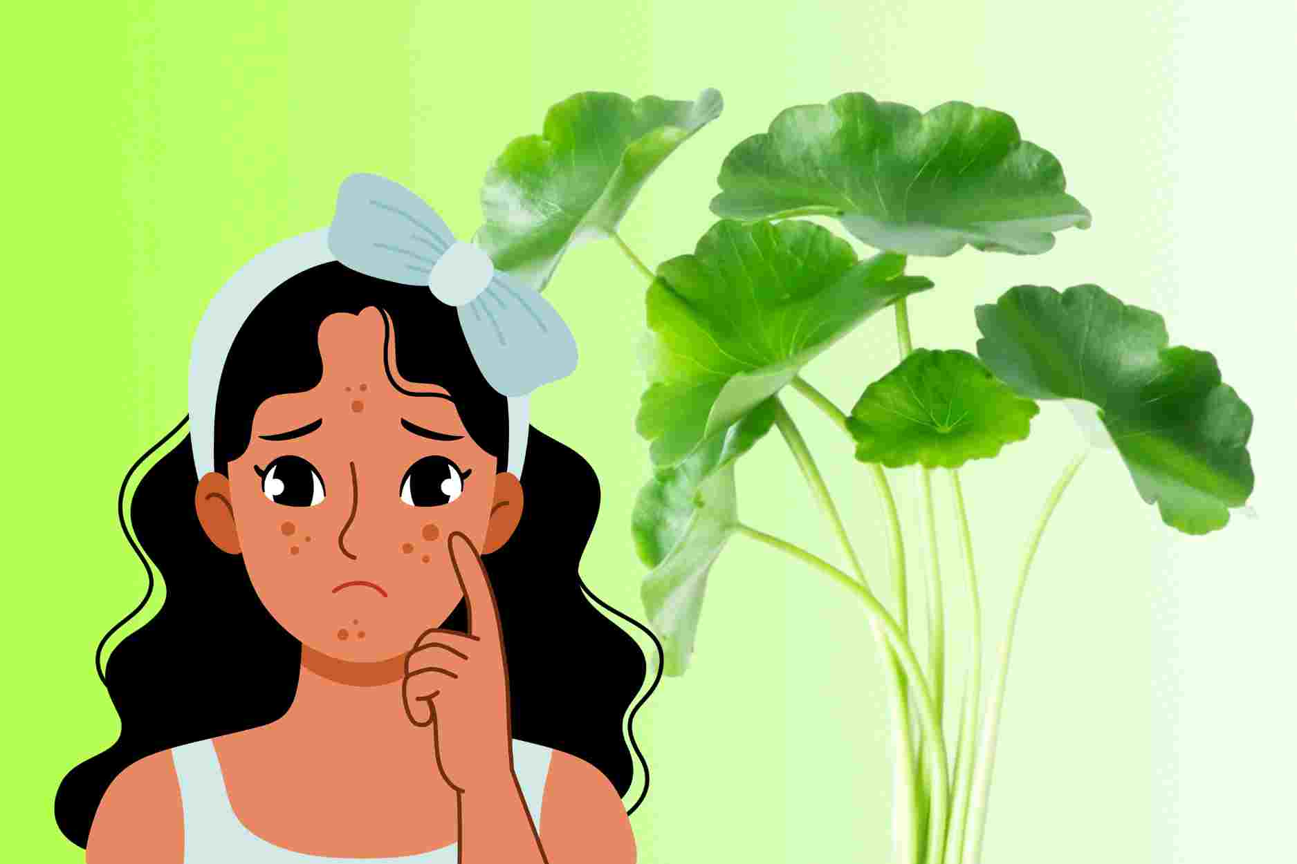Notes when treating melasma with pennywort