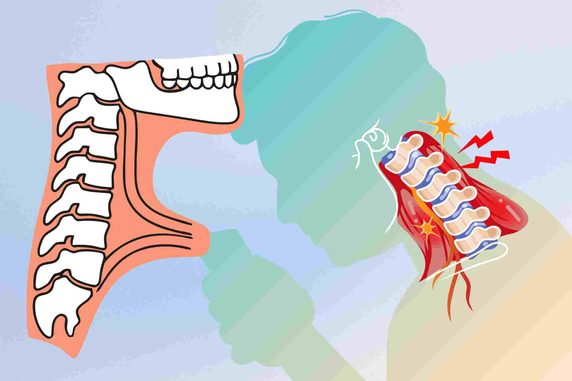 How to recognize early signs of cervical spondylosis to avoid complications