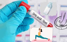 La reducción del ácido úrico dependerá de tu dieta y hábitos diarios. Foto: Như Hạ