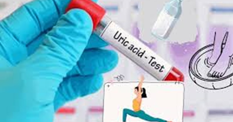 Mẹo kiểm soát acid uric tự nhiên bạn nên biết