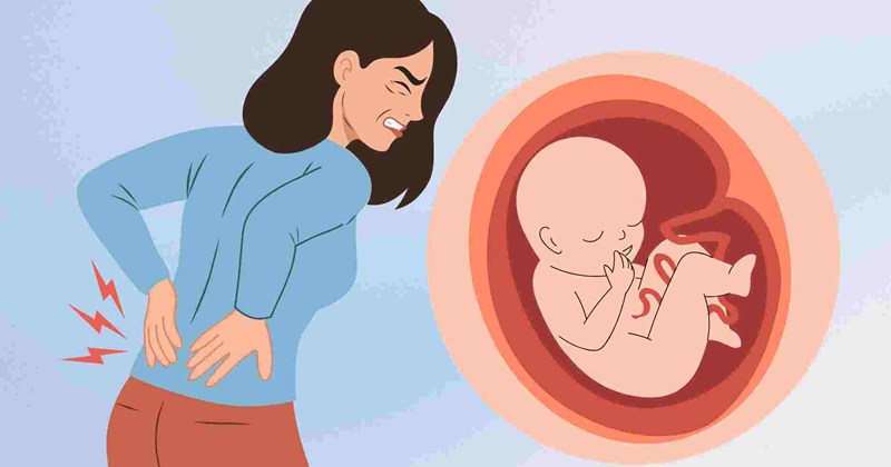 Đau lưng dưới: Dấu hiệu sớm của thai kỳ?