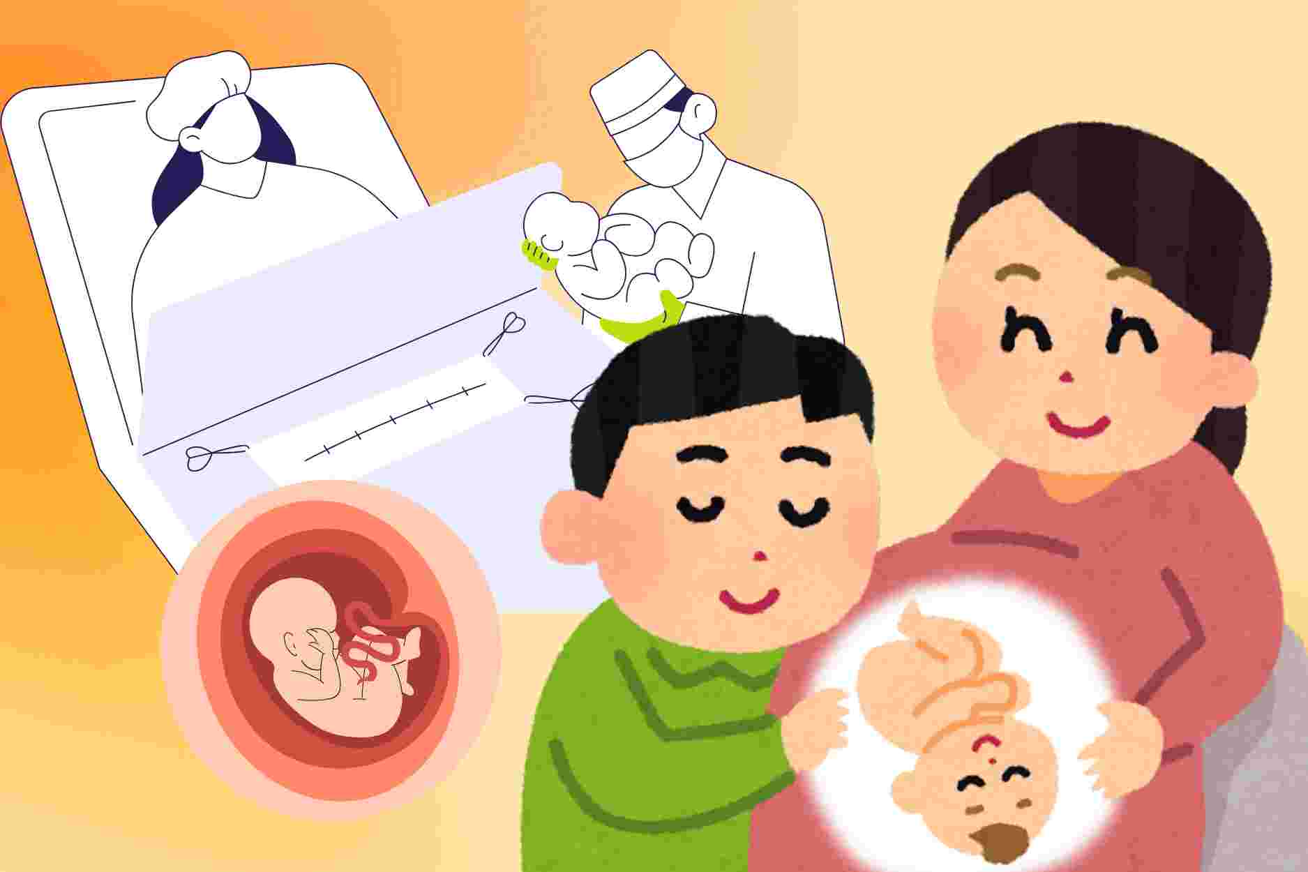 Misconceptions about cesarean section and natural birth you should know