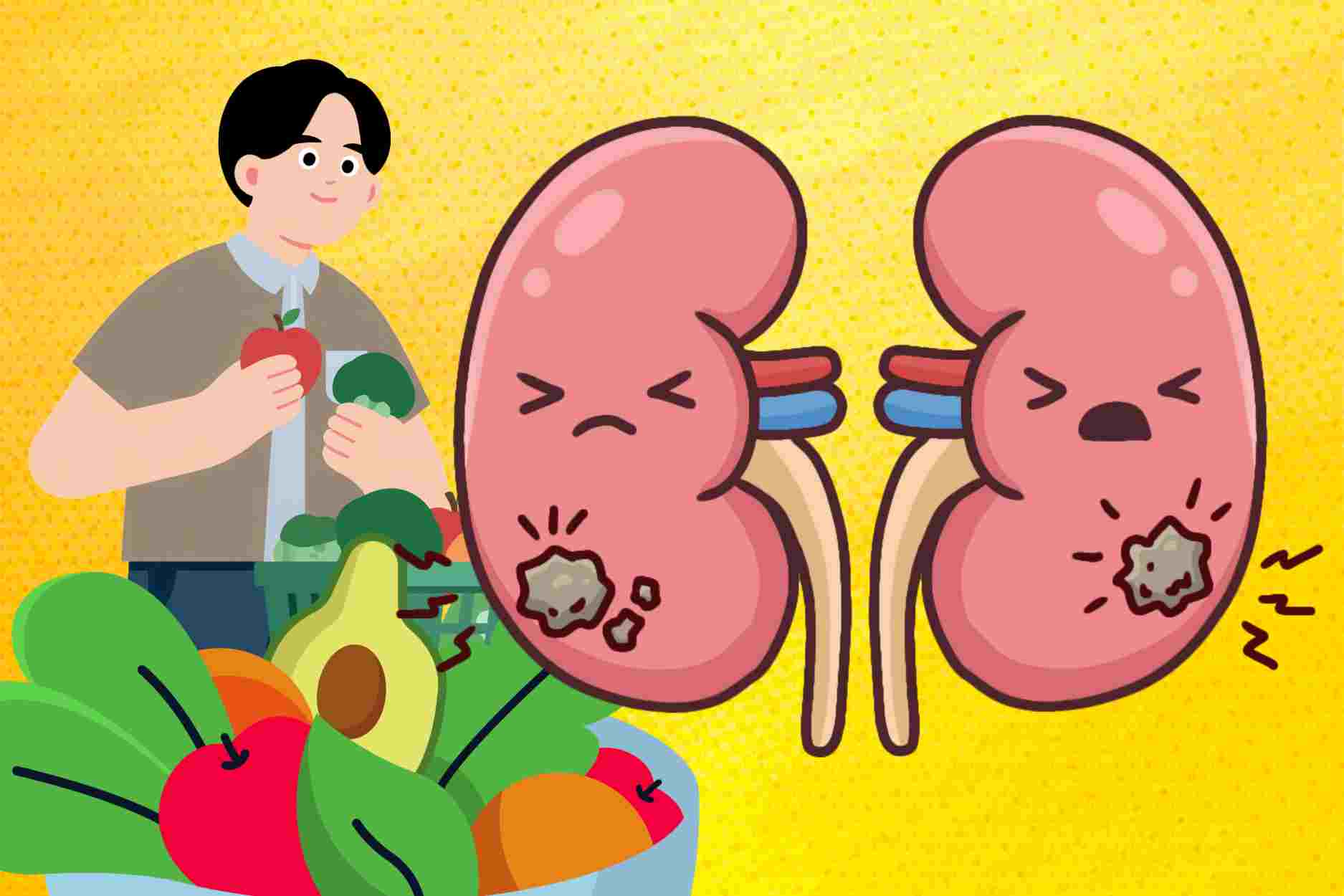 Listing safe and good foods for people with kidney stones