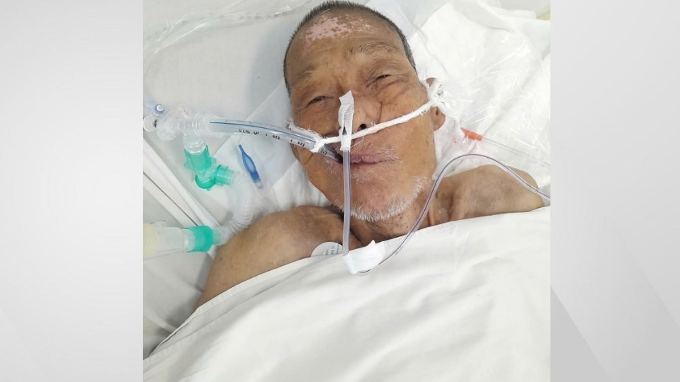 An anonymous patient is being treated at Vinh Long General Hospital in critical condition. Photo: Hoang Loc