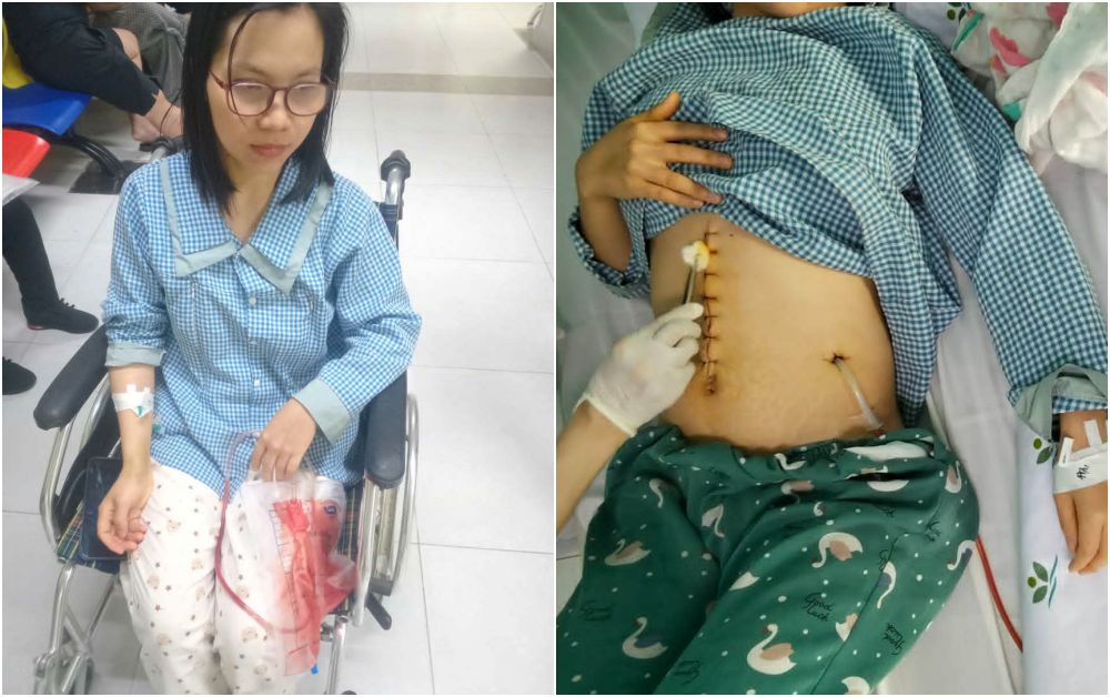 Chị Huyền Trang phẫu thuật lấy một phần gan của mình ghép cho con gái. Ảnh: Gia đình cung cấp