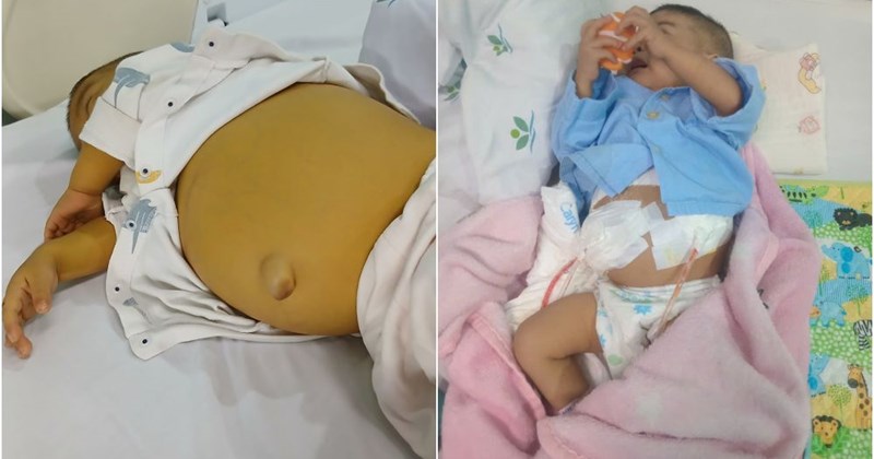 Cặp vợ chồng trẻ phá sản vì phẫu thuật ghép gan cứu con gái 1 tuổi