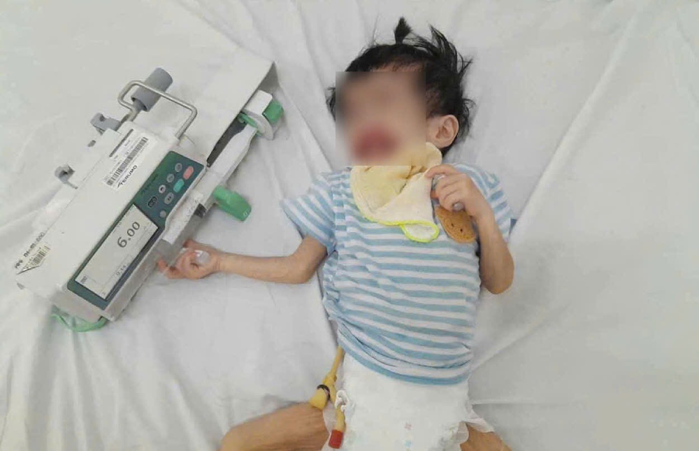 Bé Hằng sinh ra với nhiều dị tật bẩm sinh nghiêm trọng như hở hàm ếch, suy dinh dưỡng và teo thực quản nặng. Ảnh: NVCC