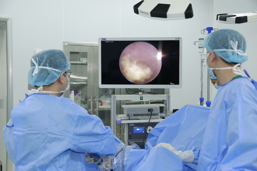의사들은 신장 결석 치료에 있어 새로운 "황금 기준"인 연조직 내시경 및 도르니에 툴리오 레이저 시술을 시행하고 있습니다. 사진: BVCC