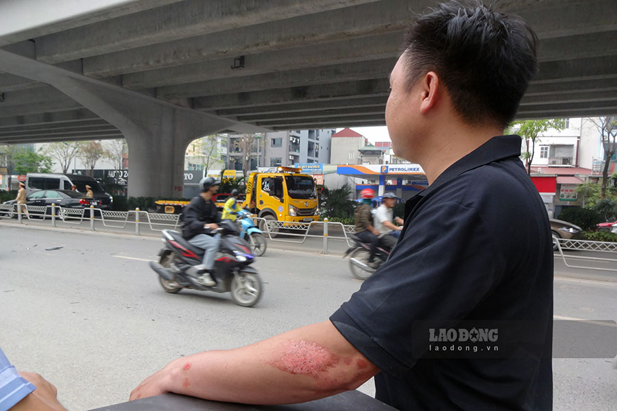 “Tôi đang di chuyển thì bỗng nhiên nghe tiếng rầm, sau đó có gì đó tác động vào xe khiến tôi ngã xuống đường. Người dân xung quanh đã nhanh chóng chạy ra đỡ tôi dậy, tay chân tôi bị trầy xước. Lúc đứng dậy thì tôi đã không thấy tài xế ôtô ở đâu cả“, anh Phạm Văn Hưng (Hà Nội) chia sẻ.