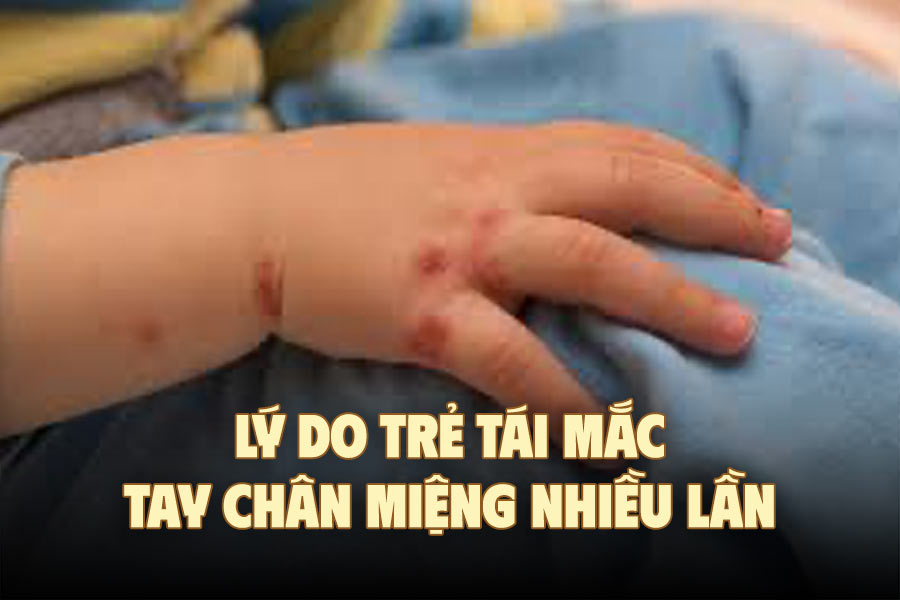 Reasons why children relapse with hand, foot and mouth disease many times