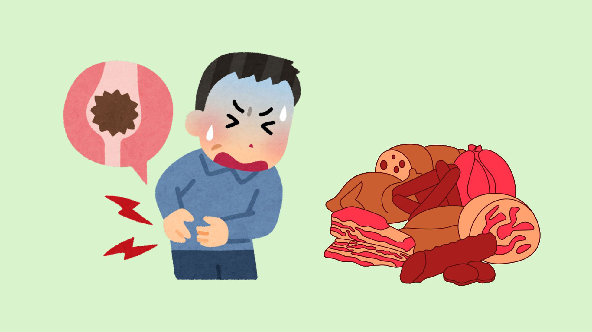 Excessive protein consumption will directly affect kidney function and contribute to the formation of stones. Graphic photo: Han Nghien