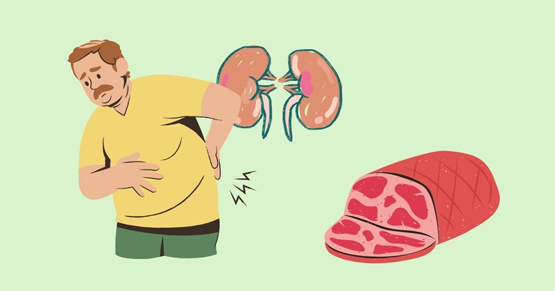 Tiêu thụ protein và nguy cơ mắc sỏi thận