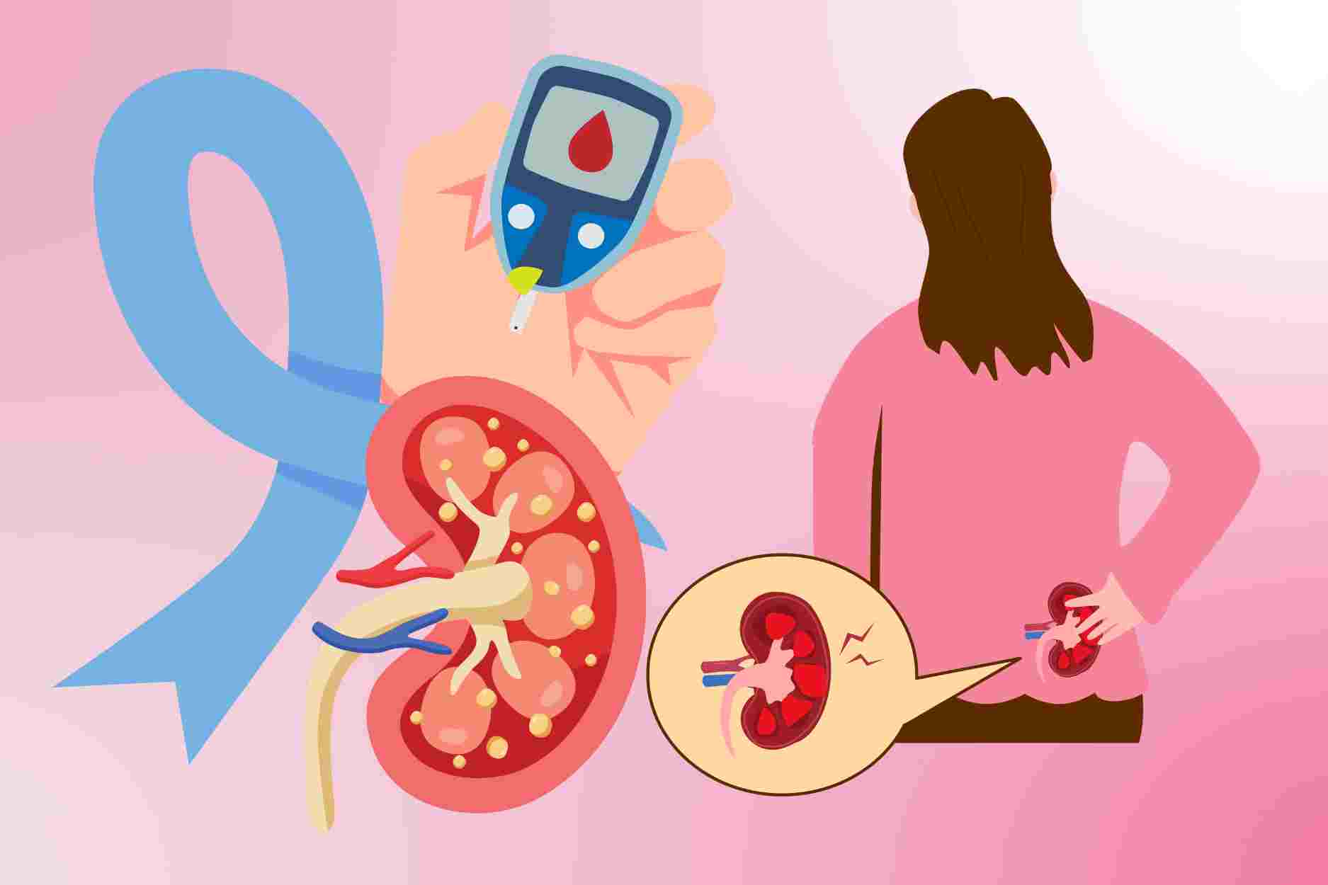 4 eating habits that harm the kidneys in people with diabetes