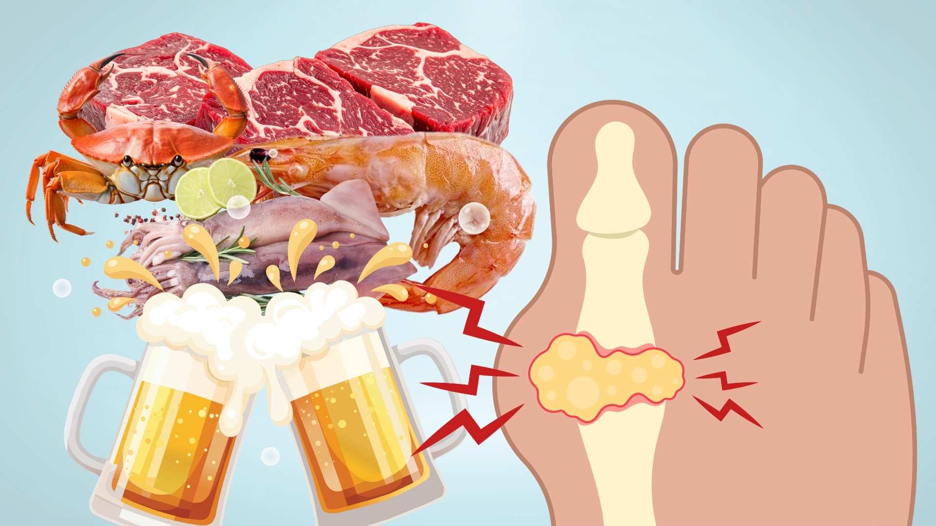 ¿Por qué el dolor de piernas después de una sesión de bebida puede ser un signo de gota