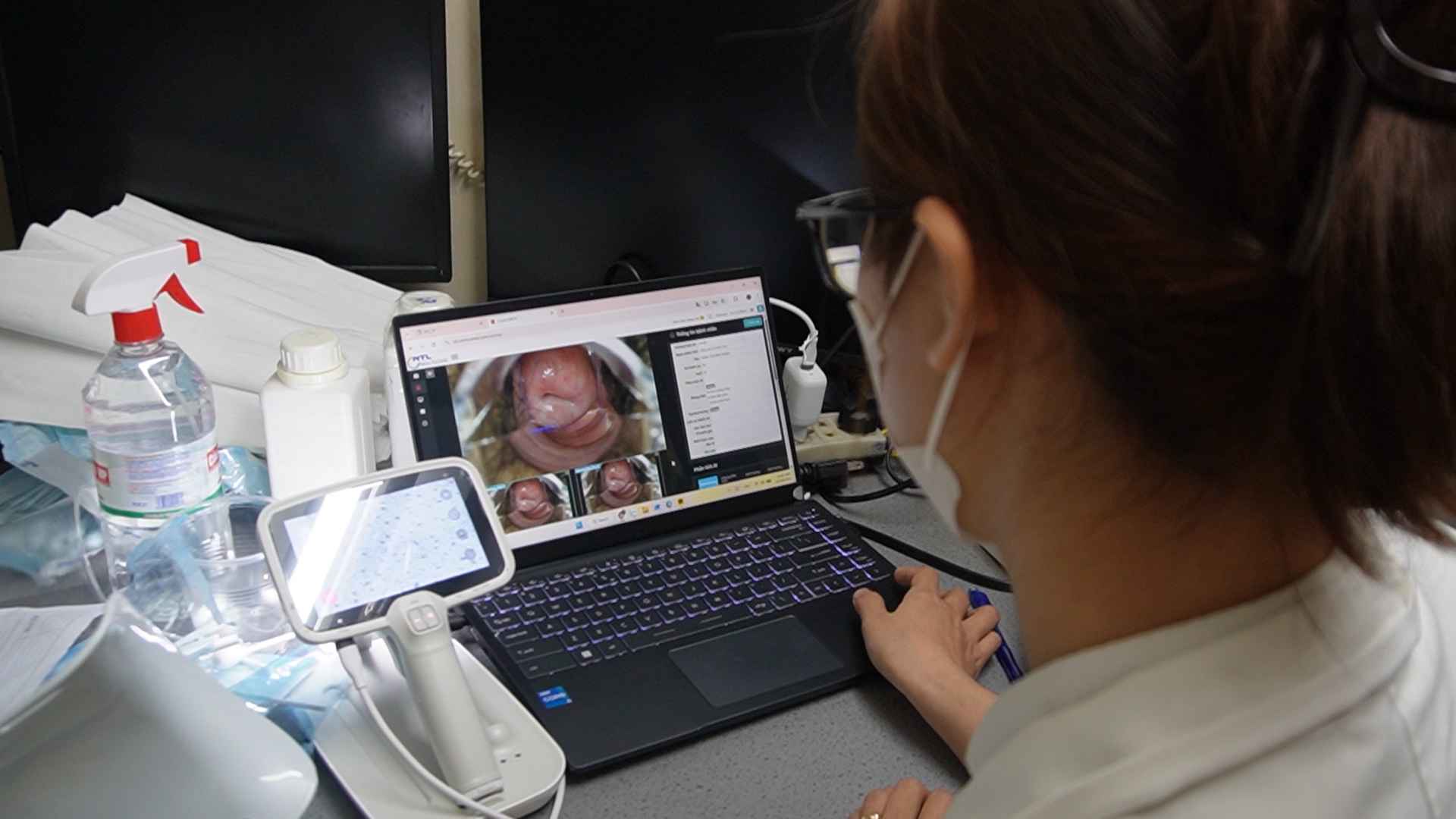Bác sĩ đọc kết quả sàng lọc ung thư cổ tử cung của bệnh nhân. Ảnh: Hoàng Khôi.