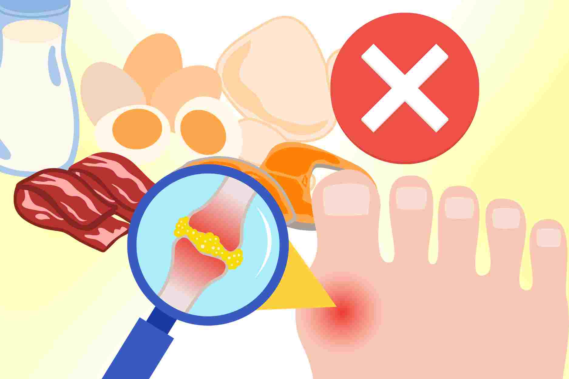 Foods that cause high uric acid but many people still eat