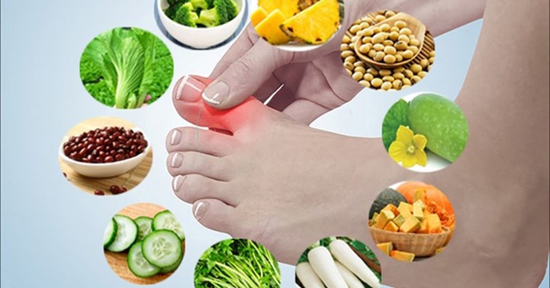 Thực phẩm giúp giảm nhanh cơn đau gout, bạn cần biết