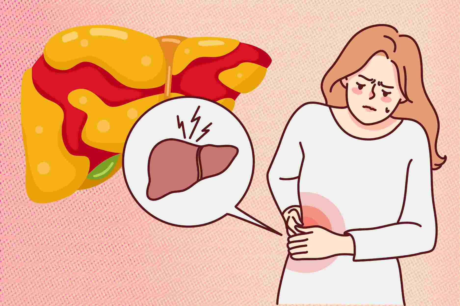 Reasons why women after 45 are prone to fatty liver disease