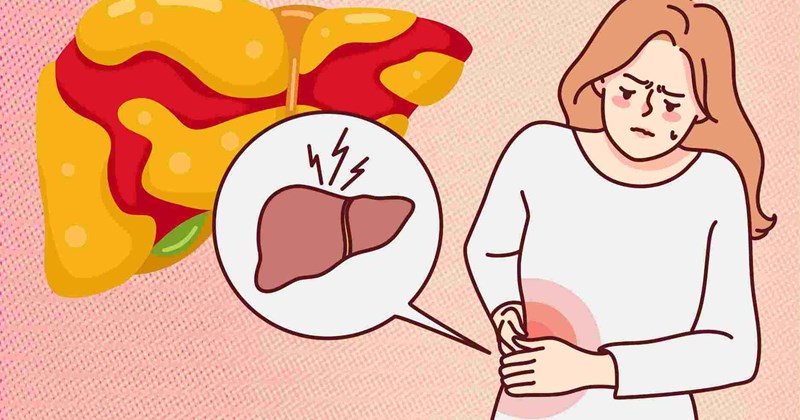 Phụ nữ sau 45 tuổi dễ mắc bệnh gan nhiễm mỡ: Nguyên nhân và phòng ngừa