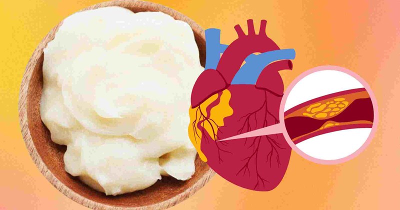 Mỡ bò ảnh hưởng thế nào đến cholesterol