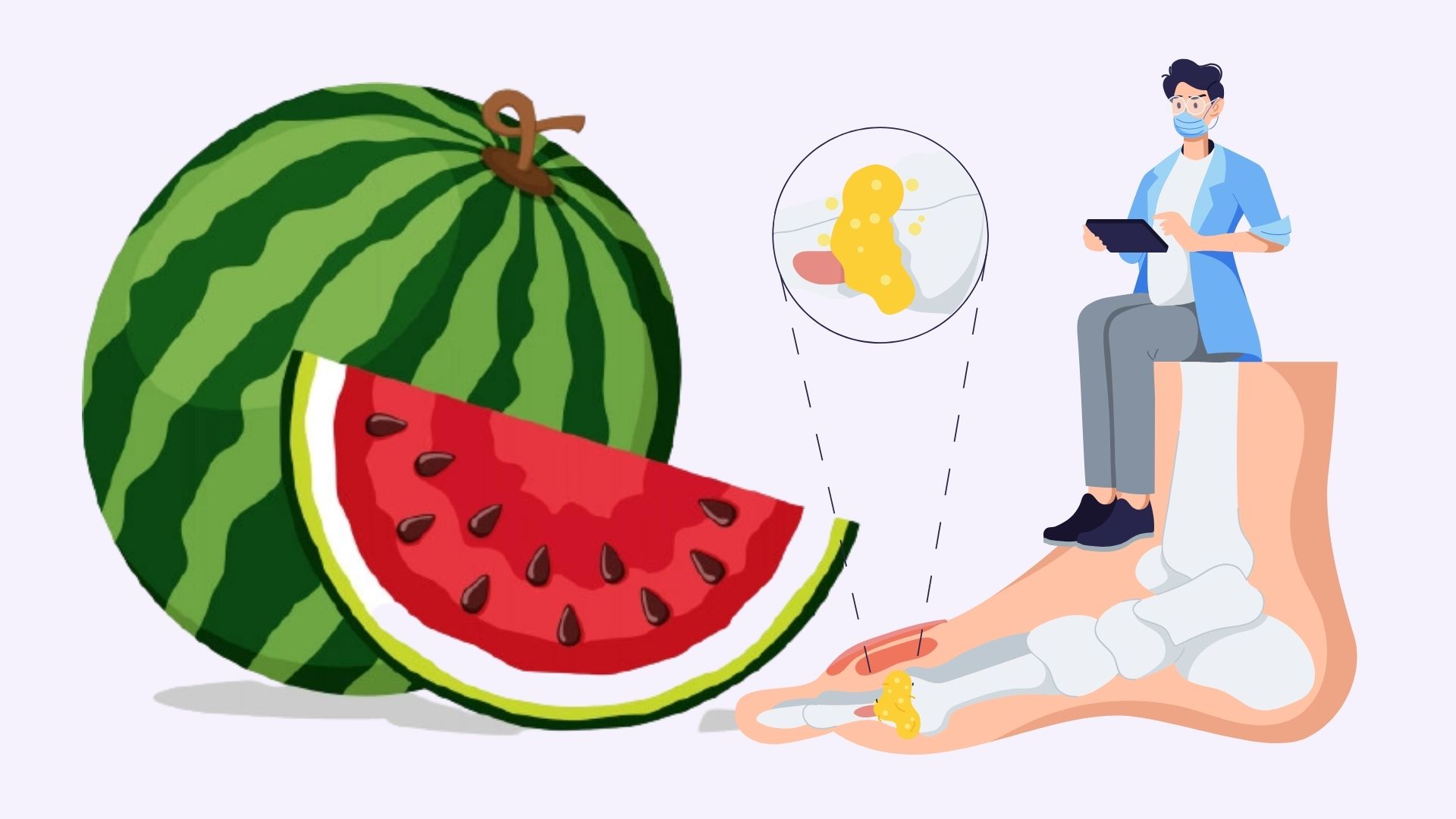 Reduce el ácido úrico con frutas en verano. Gráfico: Linh Dan