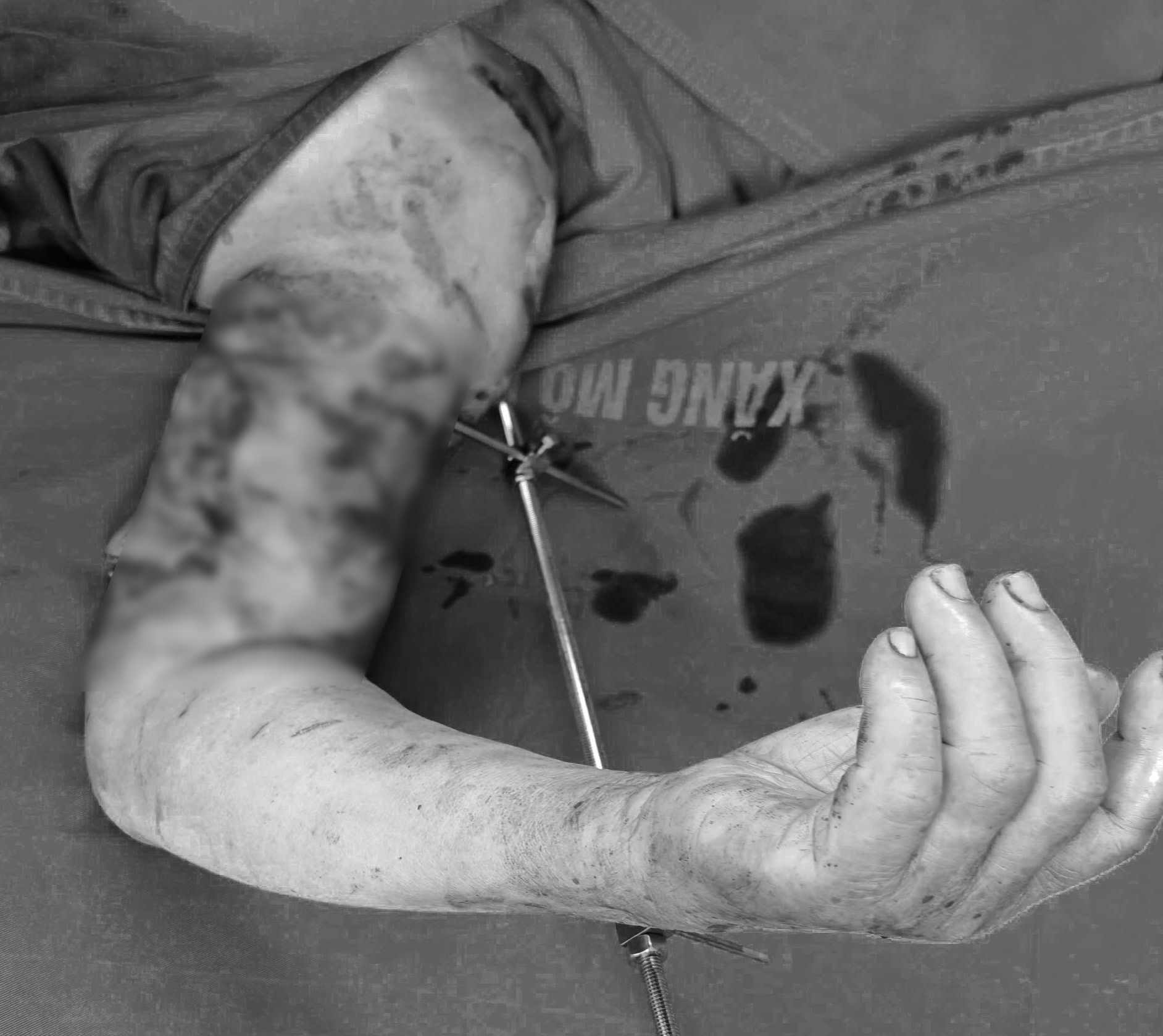 The woman was seriously injured by a dog she raised for 10 years. Photo: BVCC