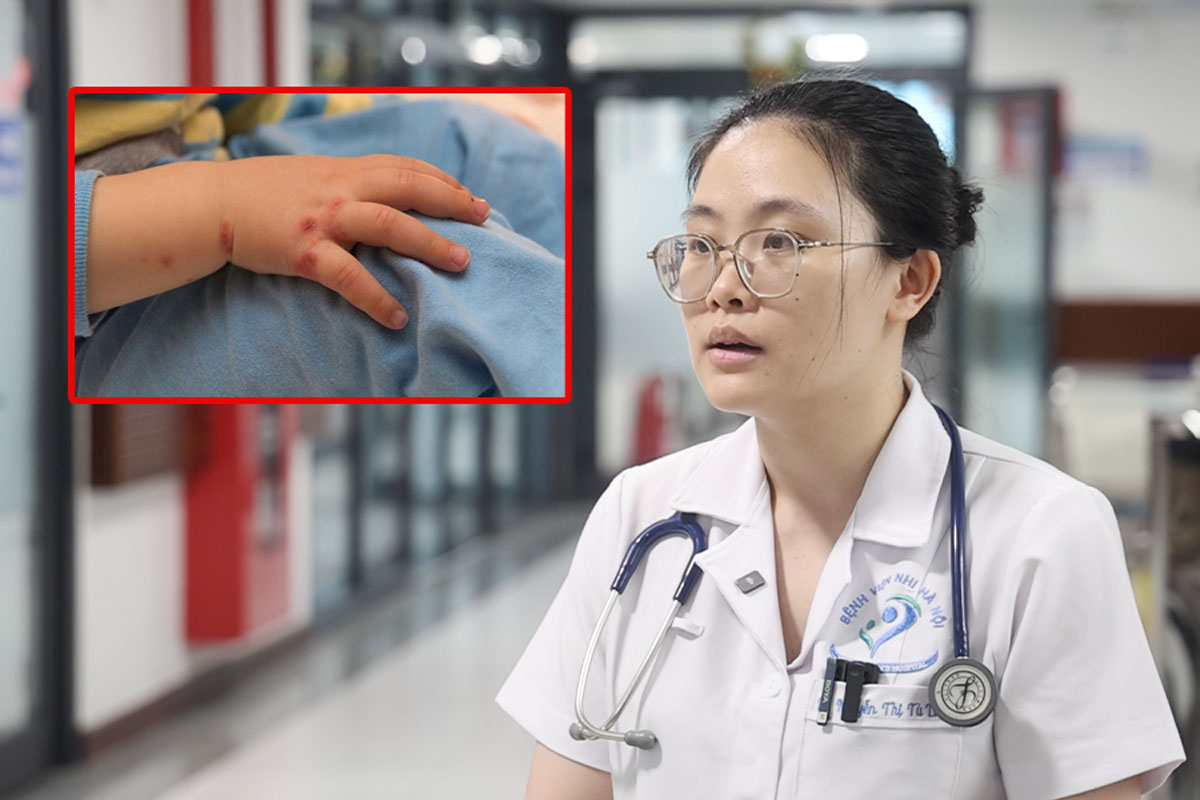 Instructions on caring for and preventing hand, foot and mouth disease for children when the disease increases