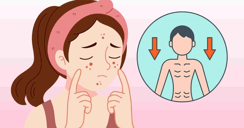 5 dấu hiệu ở da cảnh báo suy dinh dưỡng ở trẻ
