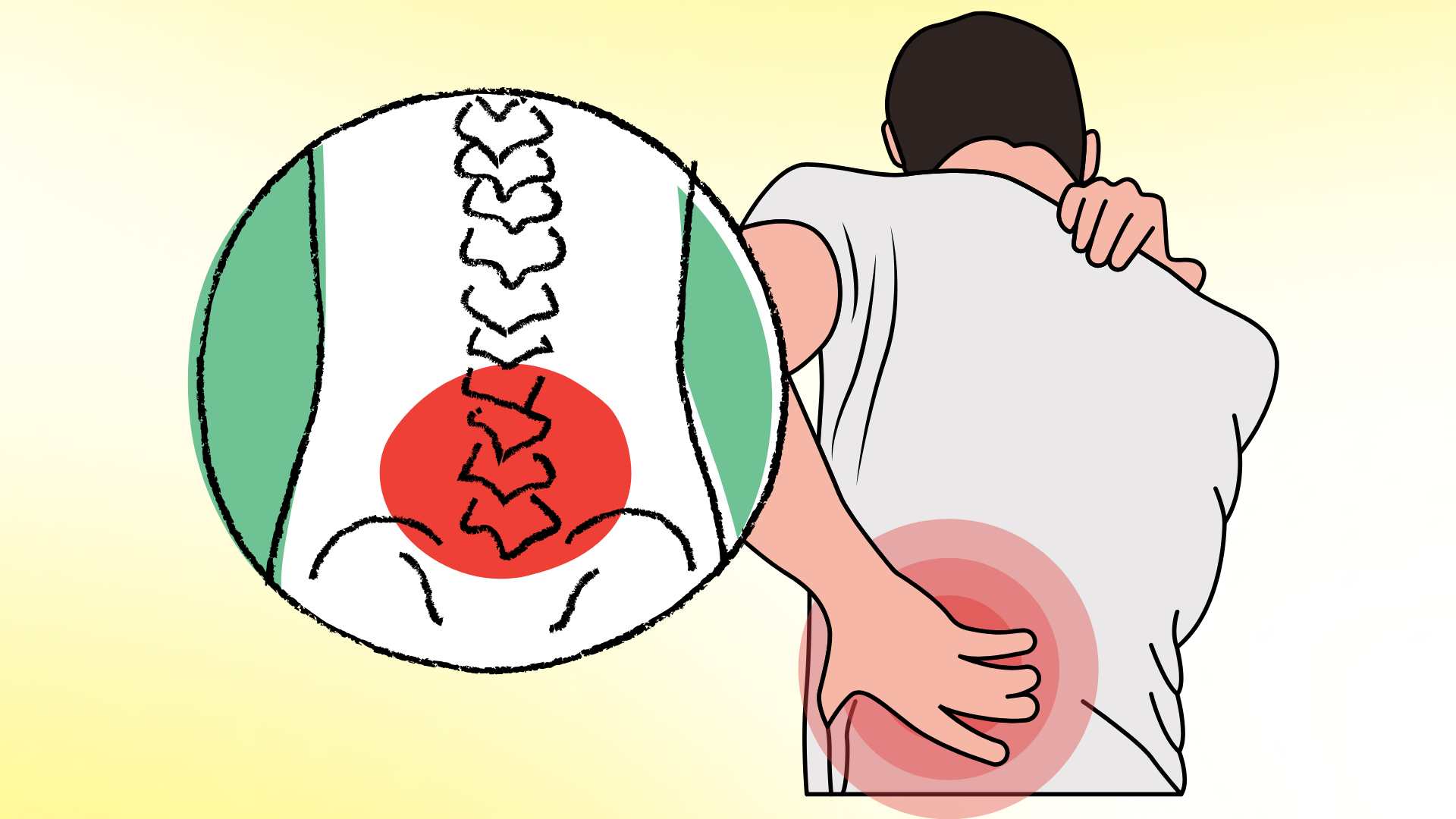 Secrets to choosing the right sleeping position to help people with back pain reduce pain significantly