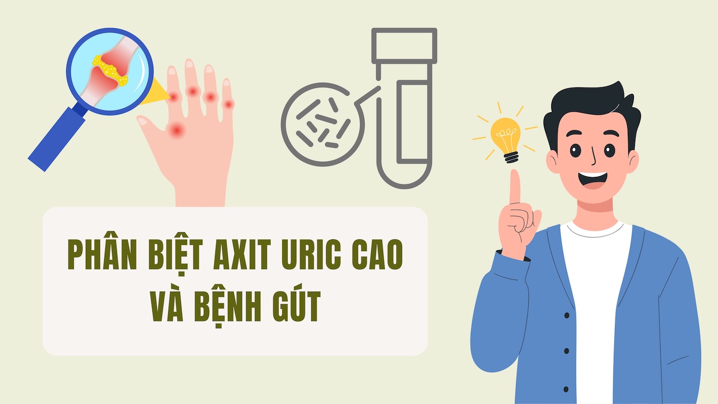 Differentiating high uric acid and gout