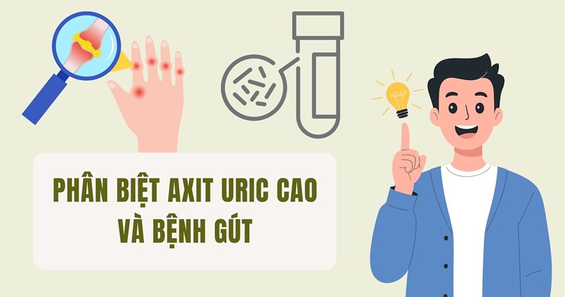 Phân biệt acid uric cao và bệnh gout