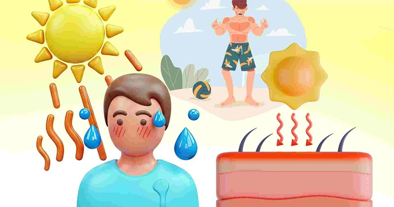 Cách phục hồi da cháy nắng sau kỳ nghỉ lễ