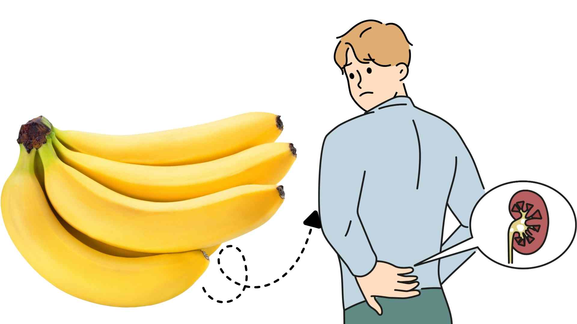 Kidney disease can be more severe if diabetics eat more bananas. Graphics: Ha May