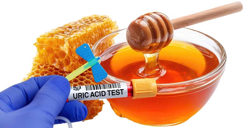 Tăng acid uric từ đồ ngọt: Tưởng tốt cho sức khỏe