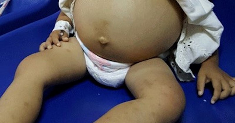 Nhiều người mang gene bệnh tan máu bẩm sinh, chỉ phát hiện khi sinh con