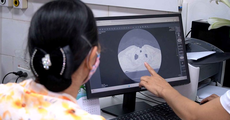 Khó thở, tức ngực: Nhiều người lo tầm soát ung thư phổi