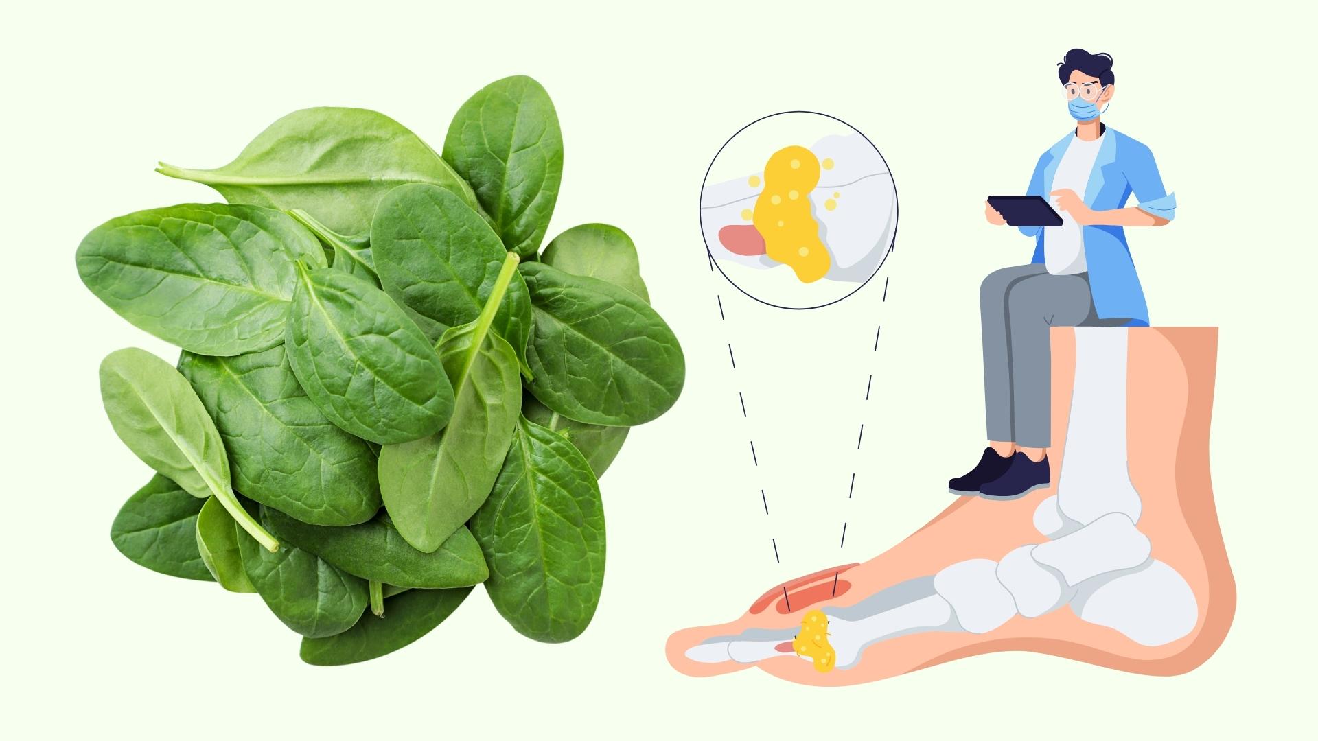 The reason why familiar vegetables increase uric acid and trigger acute gout attacks. Graphics: Linh Dan