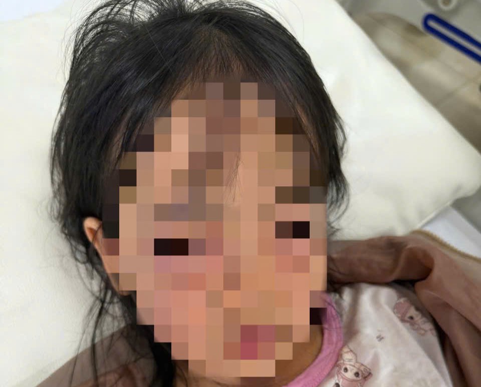 5-year-old girl hospitalized for conjunctivitis after playing with soap bubbles. Photo: People provided