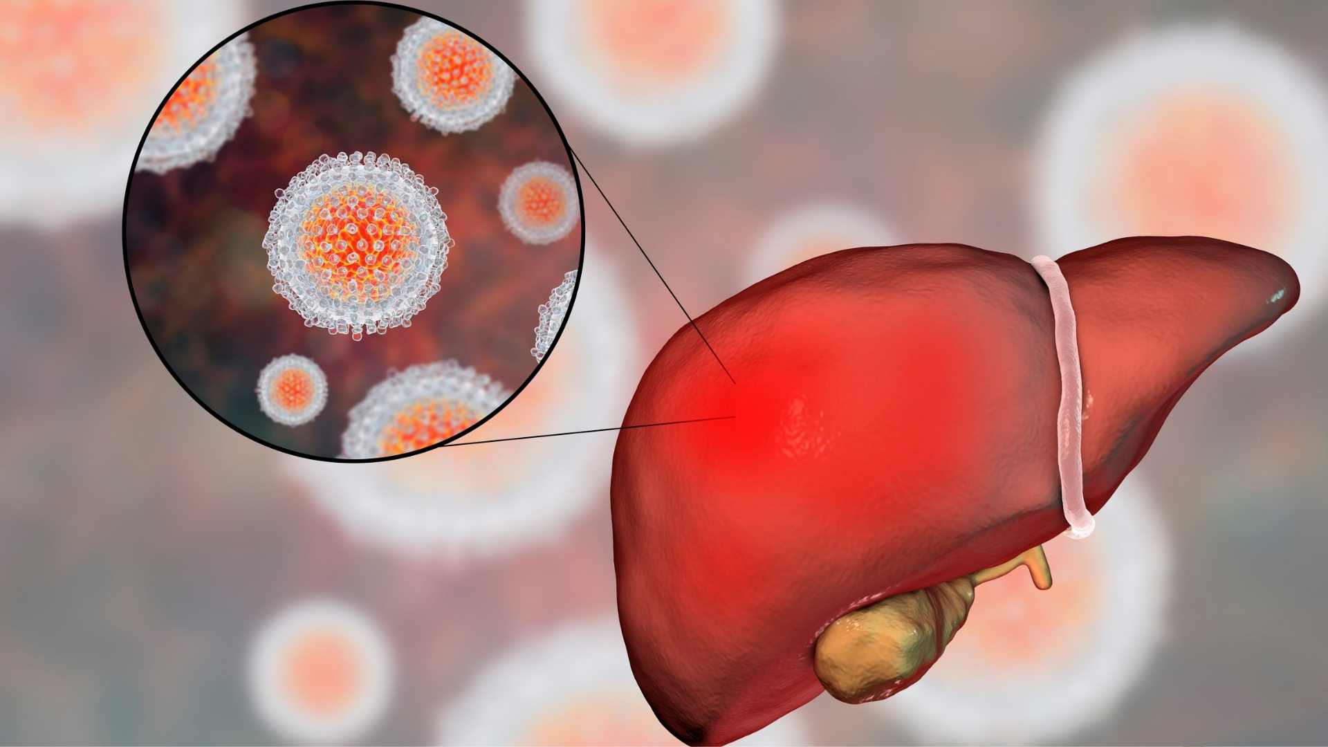 The most common routes of viral hepatitis