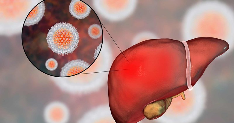 Các con đường lây nhiễm phổ biến nhất của viêm gan virus