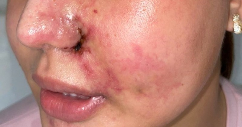 Báo động thuê phòng mổ phẫu thuật thẩm mỹ vượt chuyên môn